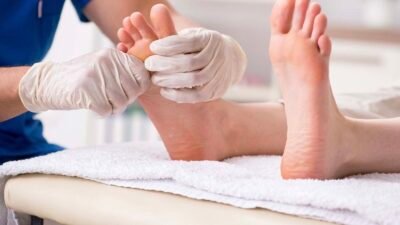 Foot-Calluses