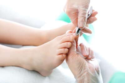 Ingrown toenail